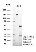 CPS1/Carbamoyl-Phosphate Synthetase (Hepatocellular Marker) Antibody in SDS-PAGE (SDS-PAGE)