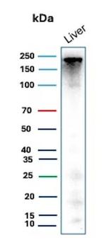 CPS1/Carbamoyl-Phosphate Synthetase (Hepatocellular Marker) Antibody in Western Blot (WB)