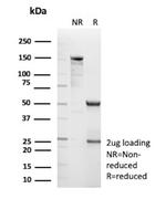 CPS1/Carbamoyl-Phosphate Synthetase (Hepatocellular Marker) Antibody in SDS-PAGE (SDS-PAGE)