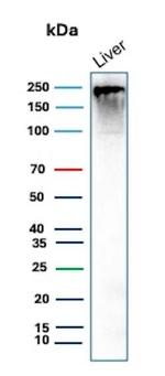CPS1/Carbamoyl-Phosphate Synthetase (Hepatocellular Marker) Antibody in Western Blot (WB)