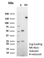 CPS1/Carbamoyl-Phosphate Synthetase (Hepatocellular Marker) Antibody in SDS-PAGE (SDS-PAGE)