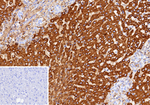 CPS1/Carbamoyl-Phosphate Synthetase (Hepatocellular Marker) Recombinant Rabbit Monoclonal Antibody (CPS1/13326R)