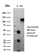 CPS1/Carbamoyl-Phosphate Synthetase (Hepatocellular Marker) Antibody in SDS-PAGE (SDS-PAGE)