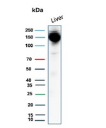 CPS1/Carbamoyl-Phosphate Synthetase (Hepatocellular Marker) Antibody in Western Blot (WB)