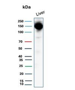 CPS1/Carbamoyl-Phosphate Synthetase (Hepatocellular Marker) Antibody in Western Blot (WB)