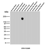 CPS1/Carbamoyl-Phosphate Synthetase (Hepatocellular Marker) Antibody in Western Blot (WB)