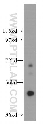 Carboxypeptidase A5 Antibody in Western Blot (WB)