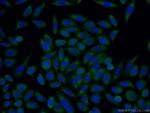 Trefoil factor 1 Antibody in Immunocytochemistry (ICC/IF)