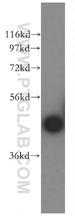 CA14 Antibody in Western Blot (WB)