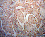 CYP3A5 Antibody in Immunohistochemistry (Paraffin) (IHC (P))
