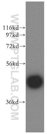 CYP3A5 Antibody in Western Blot (WB)