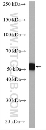 CYP3A5 Antibody in Western Blot (WB)