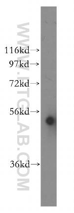 CYP3A5 Antibody in Western Blot (WB)