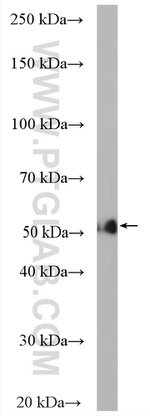 CYP3A5 Antibody in Western Blot (WB)