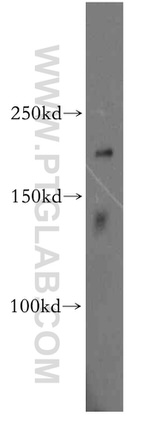 CUL7 Antibody in Western Blot (WB)