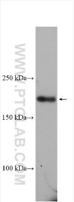 CUL7 Antibody in Western Blot (WB)