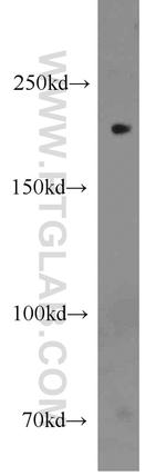 CUL7 Antibody in Western Blot (WB)