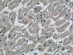 DUT Antibody in Immunohistochemistry (Paraffin) (IHC (P))