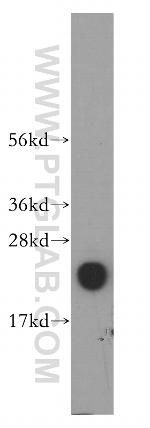 DUT Antibody in Western Blot (WB)