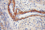 TPM4 Antibody in Immunohistochemistry (Paraffin) (IHC (P))