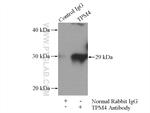 TPM4 Antibody in Immunoprecipitation (IP)