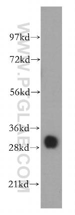 TPM4 Antibody in Western Blot (WB)