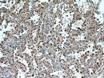 TRIM22 Antibody in Immunohistochemistry (Paraffin) (IHC (P))