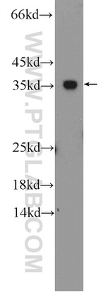 GADD45A Antibody in Western Blot (WB)