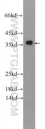 GADD45A Antibody in Western Blot (WB)