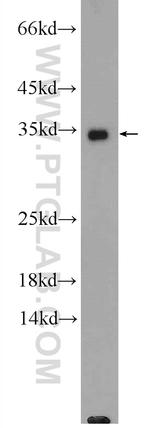 GADD45A Antibody in Western Blot (WB)