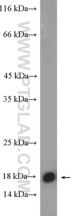 GADD45A Antibody in Western Blot (WB)