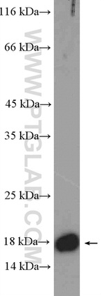 GADD45A Antibody in Western Blot (WB)