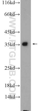 GADD45A Antibody in Western Blot (WB)
