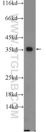 GADD45A Antibody in Western Blot (WB)