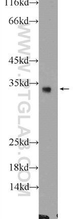 GADD45A Antibody in Western Blot (WB)
