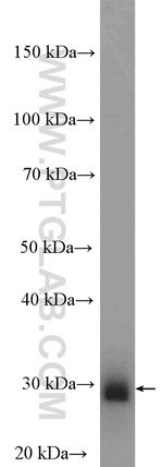 KCNIP4 Antibody in Western Blot (WB)