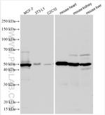 KLF15 Antibody in Western Blot (WB)