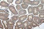 CDC2L6 Antibody in Immunohistochemistry (Paraffin) (IHC (P))