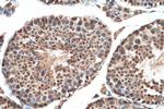 CDC2L6 Antibody in Immunohistochemistry (Paraffin) (IHC (P))