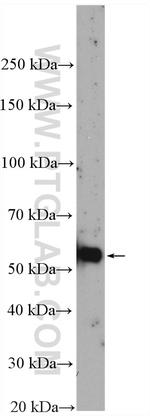 CDC2L6 Antibody in Western Blot (WB)
