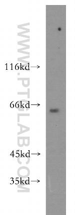 CDC2L6 Antibody in Western Blot (WB)