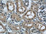 PFKFB3 Antibody in Immunohistochemistry (Paraffin) (IHC (P))
