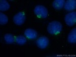TRAK2 Antibody in Immunocytochemistry (ICC/IF)