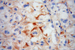 TRAK2 Antibody in Immunohistochemistry (Paraffin) (IHC (P))