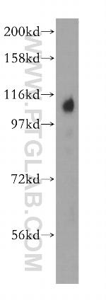 TRAK2 Antibody in Western Blot (WB)