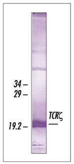 CD3z Antibody in Western Blot (WB)