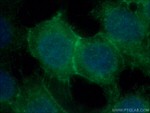 P-cadherin Antibody in Immunocytochemistry (ICC/IF)