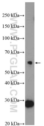 BTBD6 Antibody in Western Blot (WB)