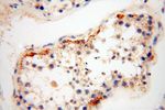 TSLP Antibody in Immunohistochemistry (Paraffin) (IHC (P))