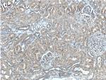 TSLP Antibody in Immunohistochemistry (Paraffin) (IHC (P))